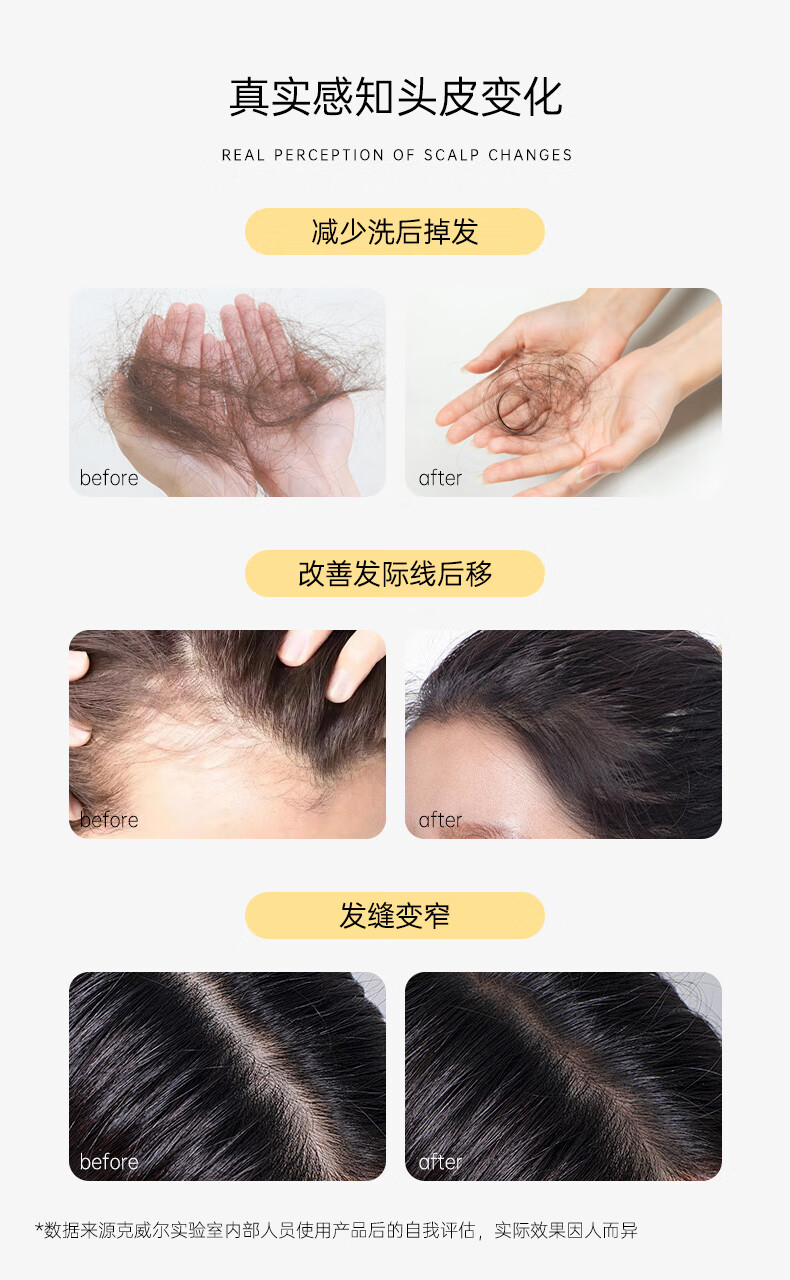 男士生姜洗發水